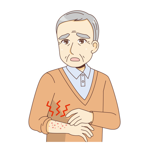 湿疹ができる男性高齢者（その他高齢者の病気・怪我・事故/医療・病気）のイラスト