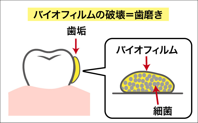 【介護技術】介護の現場における口腔ケアの目的・必要性