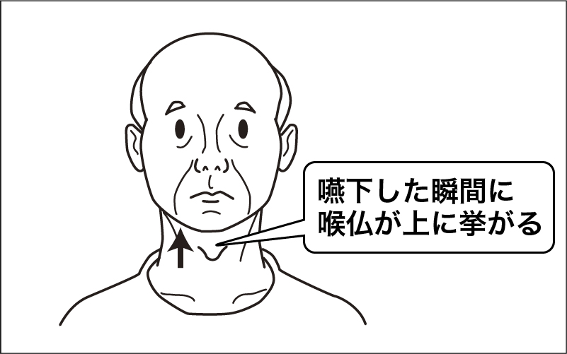 【食事介助】誤嚥や窒息が起こりにくい基本の手順・コツを分かりやすく解説！