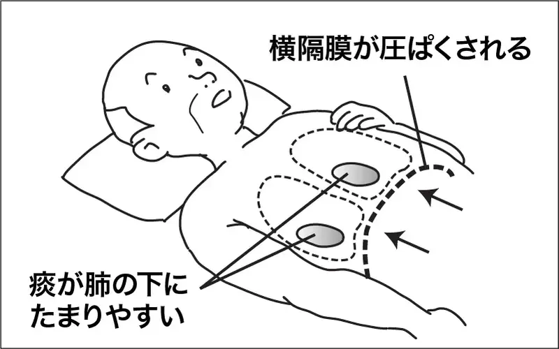 Jpsipokenwlud ダウンロード ポジショニング 側臥 位 イラスト 簡単