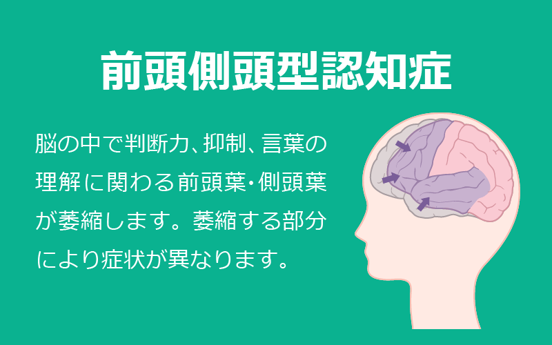 4大認知症：前頭側頭型認知症