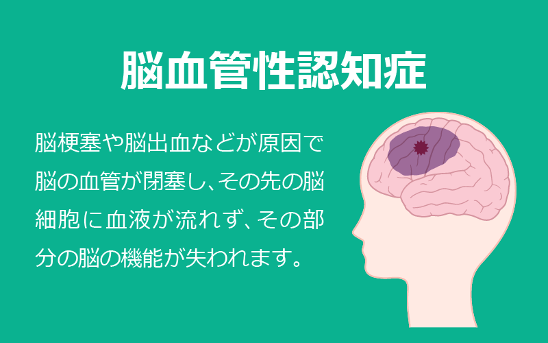 4大認知症：脳血管性認知症