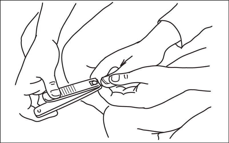 【介護技術】介護職が実施できる爪切りの条件・方法