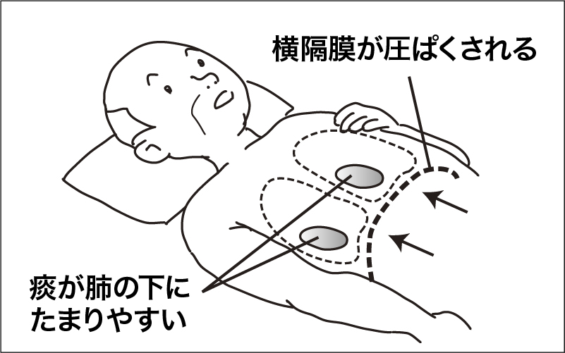 体位変換 仰臥位 側臥位のポジショニング介護の基本を解説 介護アンテナ