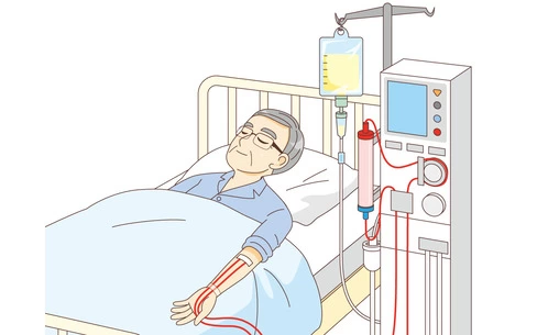 人工透析の治療を受ける男性高齢者