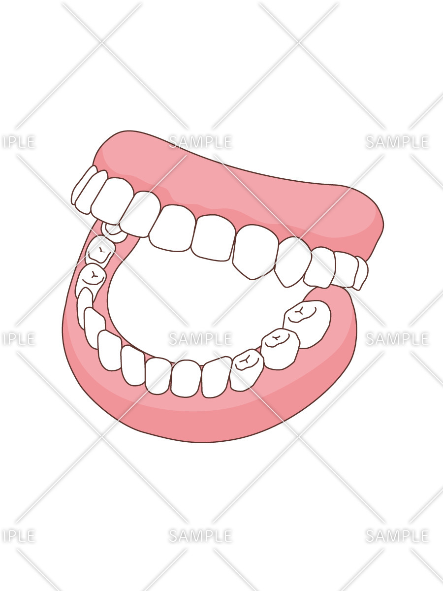 総入れ歯（入れ歯/福祉用具）のイラスト