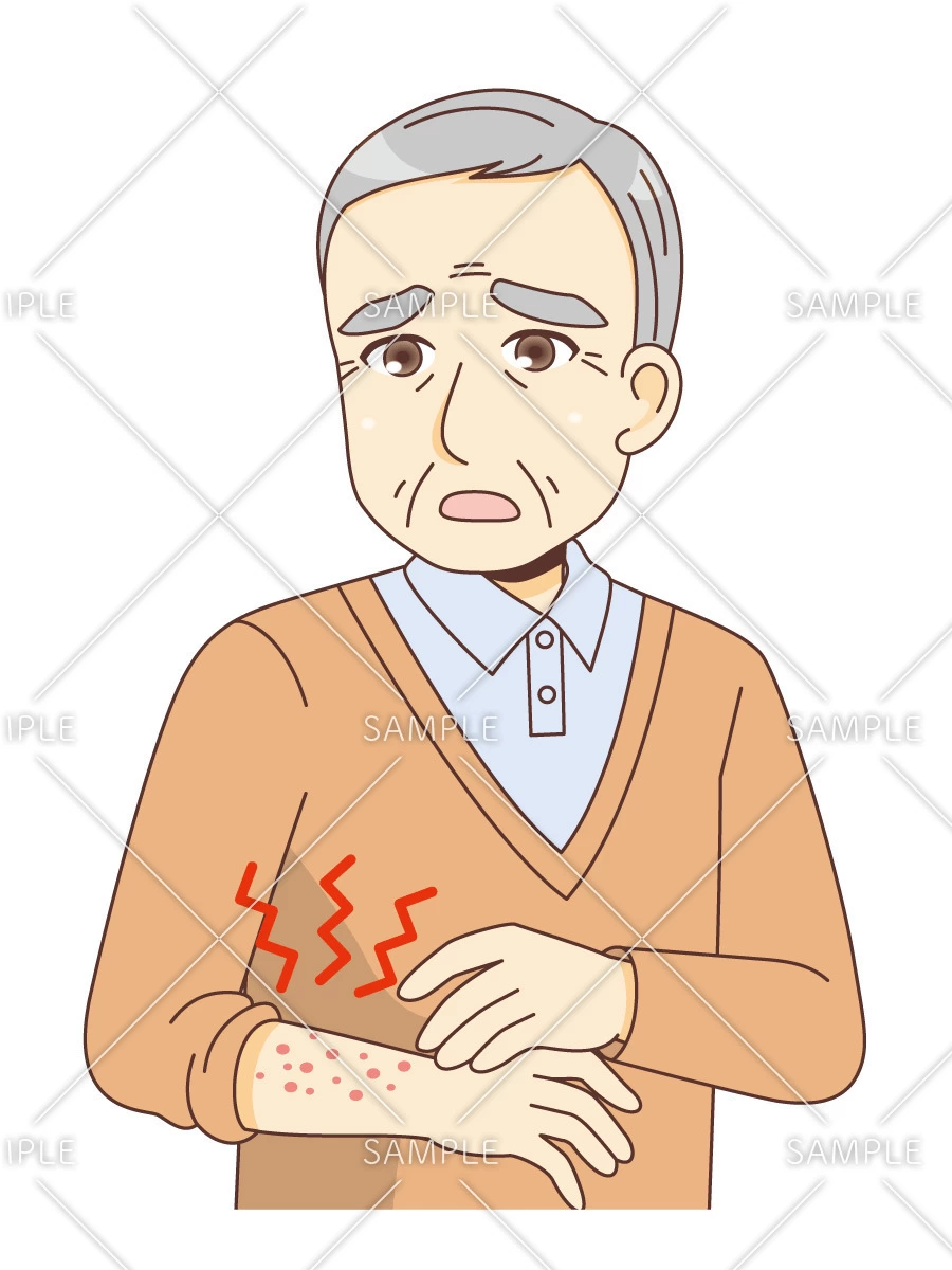 湿疹ができる男性高齢者（その他高齢者の病気・怪我・事故/医療・病気）のイラスト