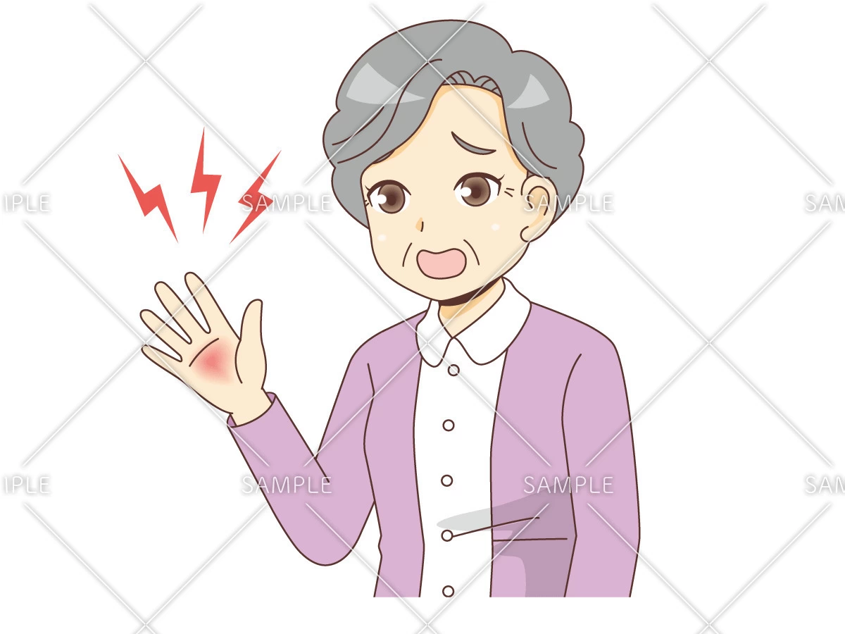 やけどをする女性高齢者（その他高齢者の病気・怪我・事故/医療・病気）のイラスト